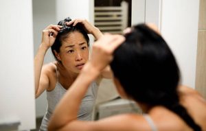 產後脫髮